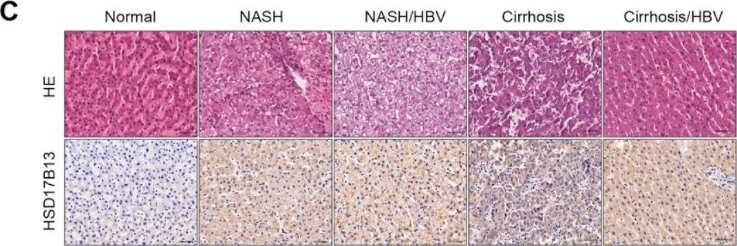 HSD17B13 Antibody - Azide and BSA Free
