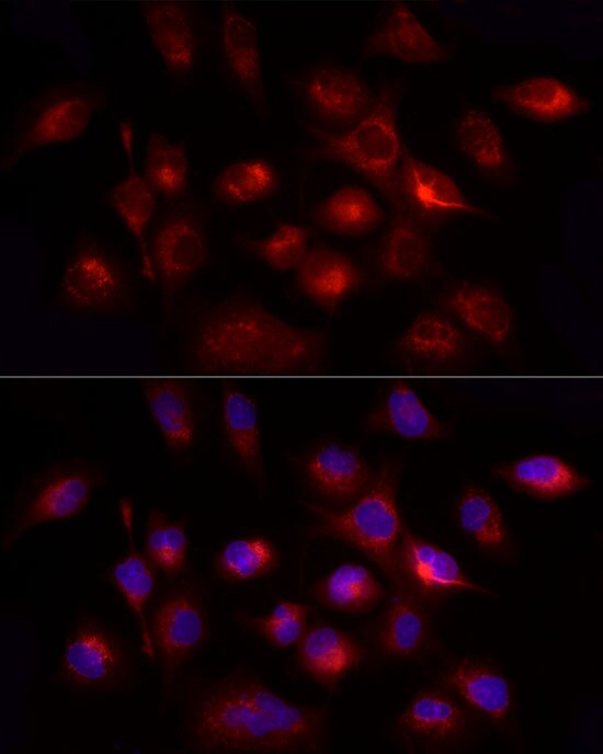 GHRH Antibody - Azide and BSA Free