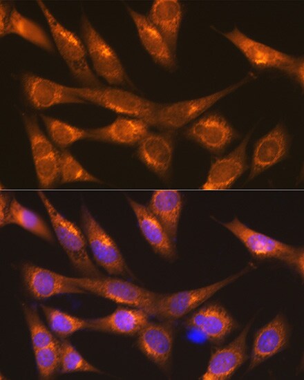 LMAN1 Antibody - Azide and BSA Free