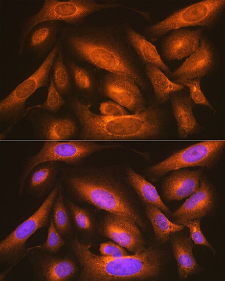 LMAN1 Antibody - Azide and BSA Free
