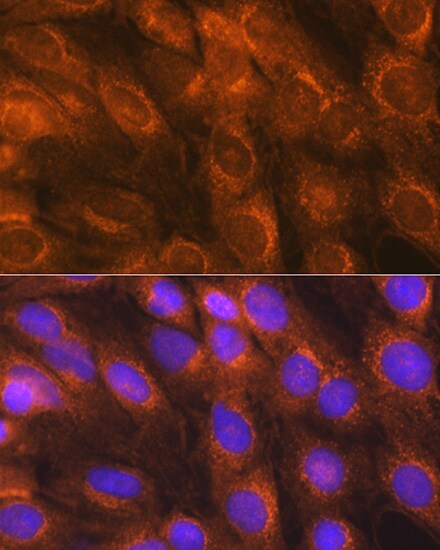 LMAN1 Antibody - Azide and BSA Free