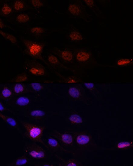 KLHL8 Antibody - Azide and BSA Free