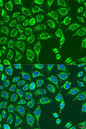 MATN3 Antibody - BSA Free