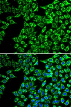 LIPC Antibody - BSA Free