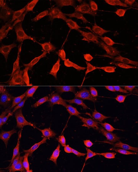 DNASE1 Antibody - Azide and BSA Free
