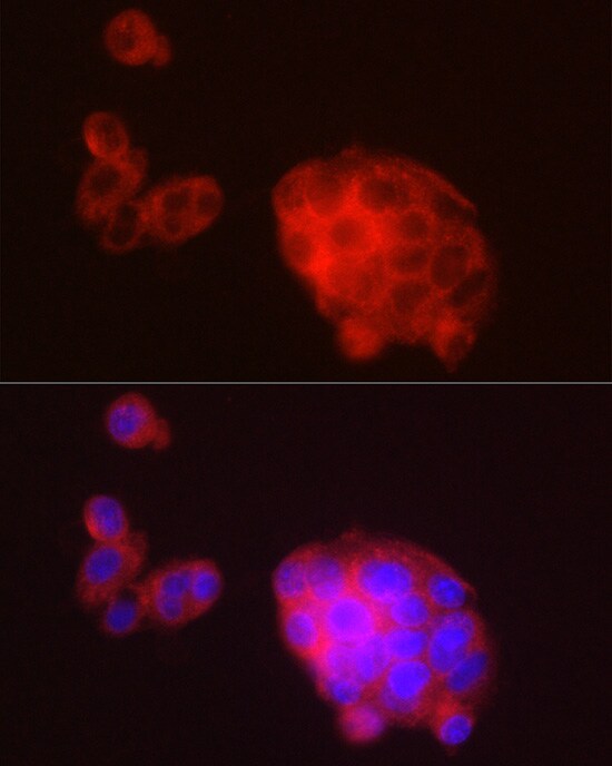 METTL7A Antibody - BSA Free