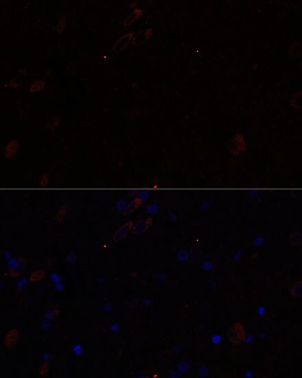 KIF17 Antibody - Azide and BSA Free