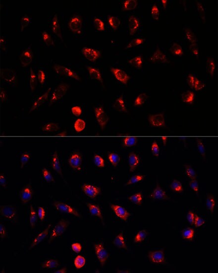 GALNT2 Antibody - BSA Free