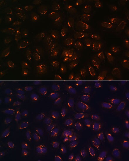 GALNT2 Antibody - BSA Free