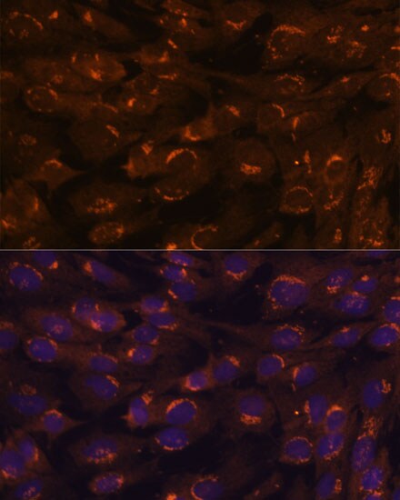 GALNT2 Antibody - BSA Free
