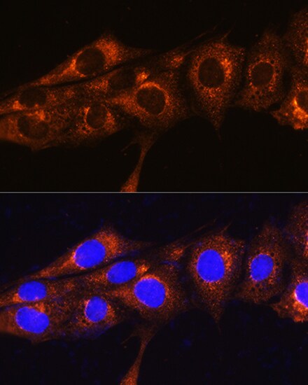 FREM2 Antibody - Azide and BSA Free