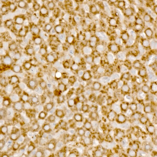 MCCC1 Antibody - BSA Free