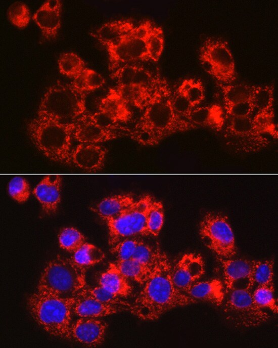METTL7B Antibody - Azide and BSA Free