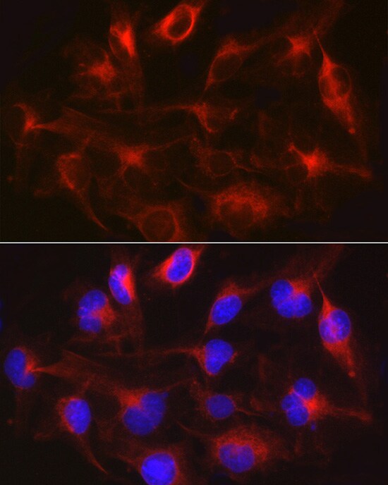 METTL7B Antibody - Azide and BSA Free