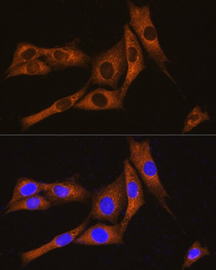 GNAT3 Antibody - Azide and BSA Free