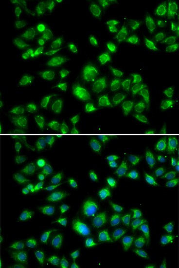 MBTPS1 Antibody - Azide and BSA Free