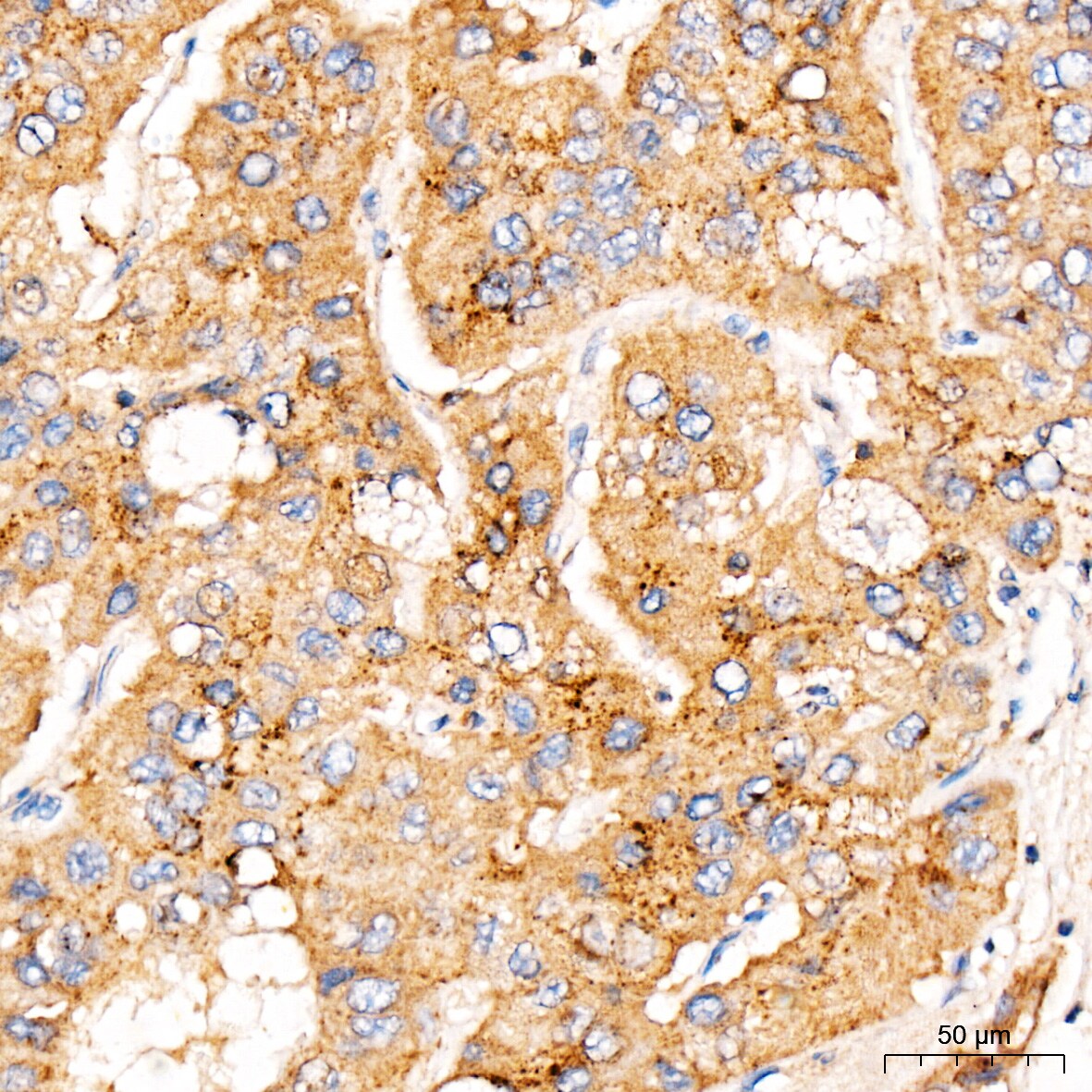 MBTPS1 Antibody - Azide and BSA Free