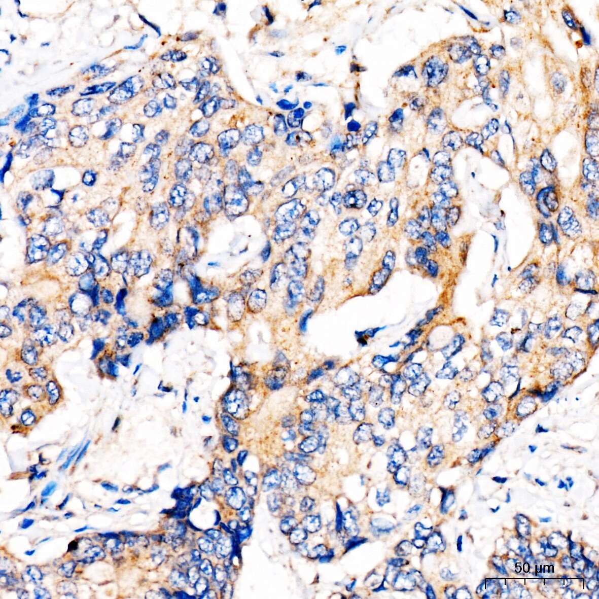 MBTPS1 Antibody - Azide and BSA Free