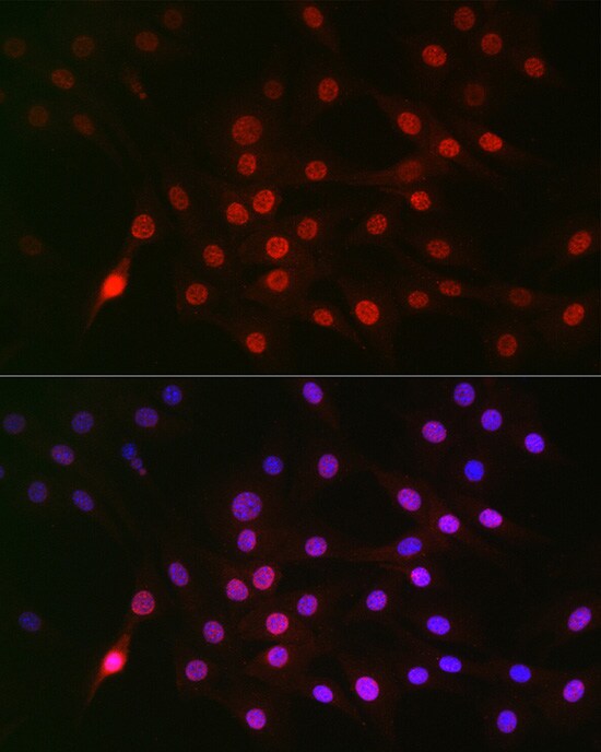 Cyclin E1 [p Thr395] Antibody - BSA Free