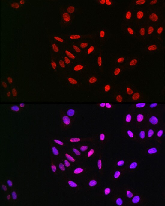 Cyclin E1 [p Thr395] Antibody - BSA Free