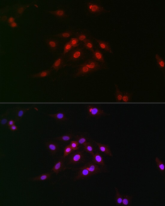 Cyclin E1 [p Thr395] Antibody - BSA Free