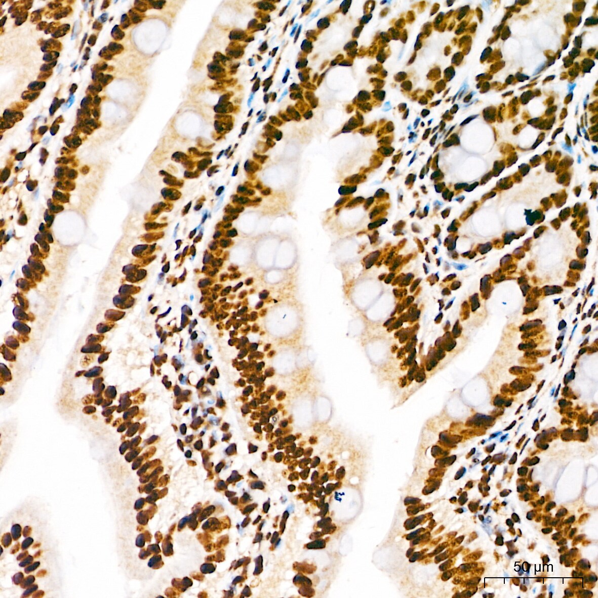 Elk-1 [p Ser383] Antibody - BSA Free