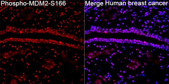 MDM2/HDM2 [p Ser166] Antibody - BSA Free