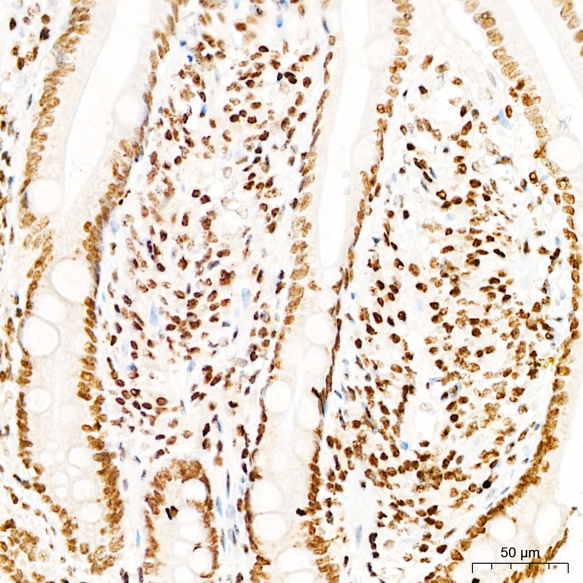 DNA-PKcs [p Ser2056] Antibody - Azide and BSA Free