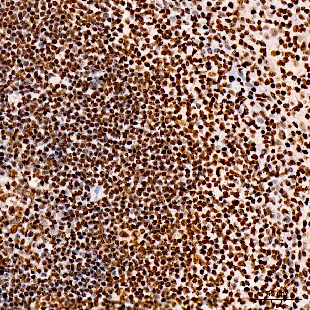 IRF3 [p Ser396] Antibody - BSA Free