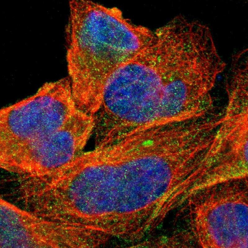 MRP1 Antibody - BSA Free Immunocytochemistry/ Immunofluorescence: MRP1 Antibody [NBP3-05508]