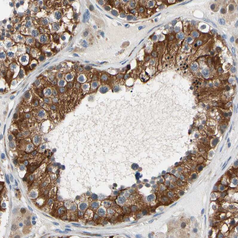 FATP6/SLC27A6 Antibody - BSA Free Immunohistochemistry-Paraffin: FATP6/SLC27A6 Antibody [NBP3-05511]