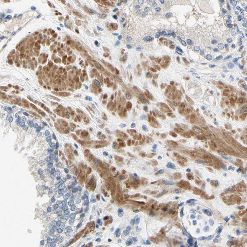 FATP6/SLC27A6 Antibody - BSA Free Immunohistochemistry-Paraffin: FATP6/SLC27A6 Antibody [NBP3-05511]