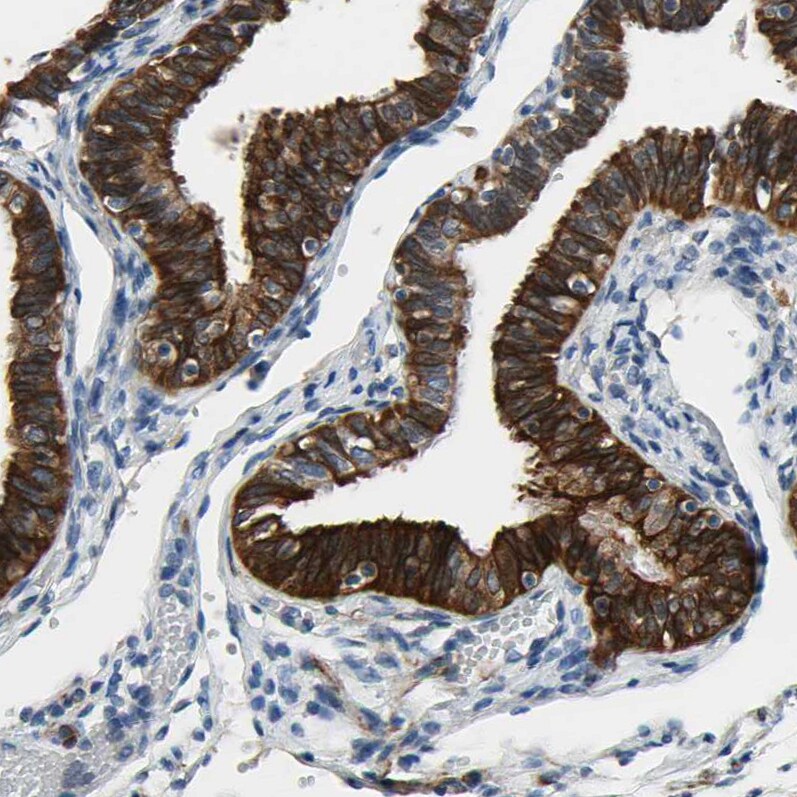 FATP6/SLC27A6 Antibody - BSA Free Immunohistochemistry-Paraffin: FATP6/SLC27A6 Antibody [NBP3-05511]