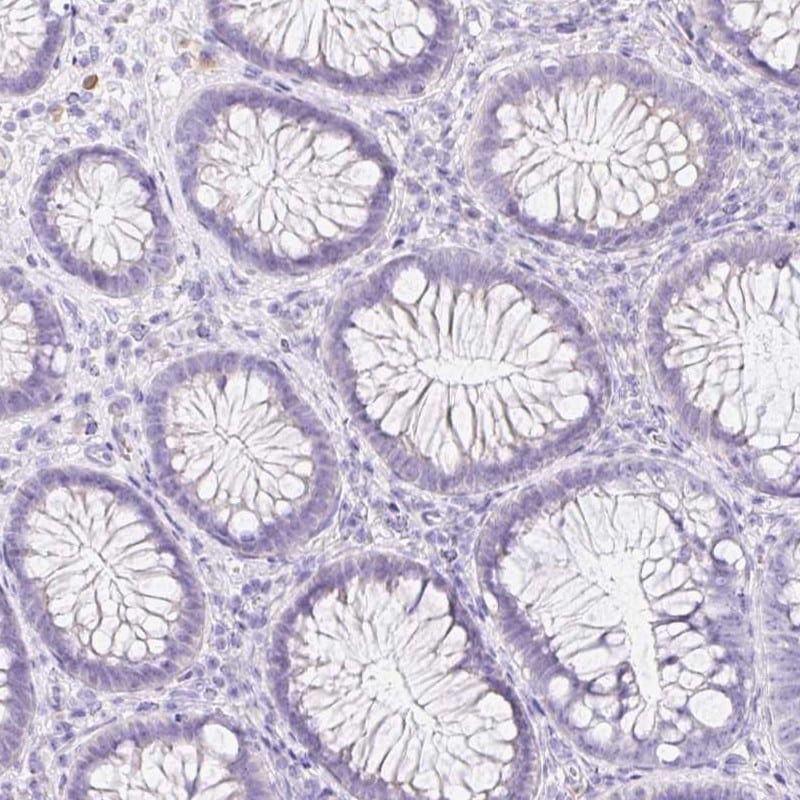 Kallikrein 8/Neuropsin Antibody - BSA Free Immunohistochemistry: Kallikrein 8/Neuropsin Antibody - BSA Free [NBP3-05517]
