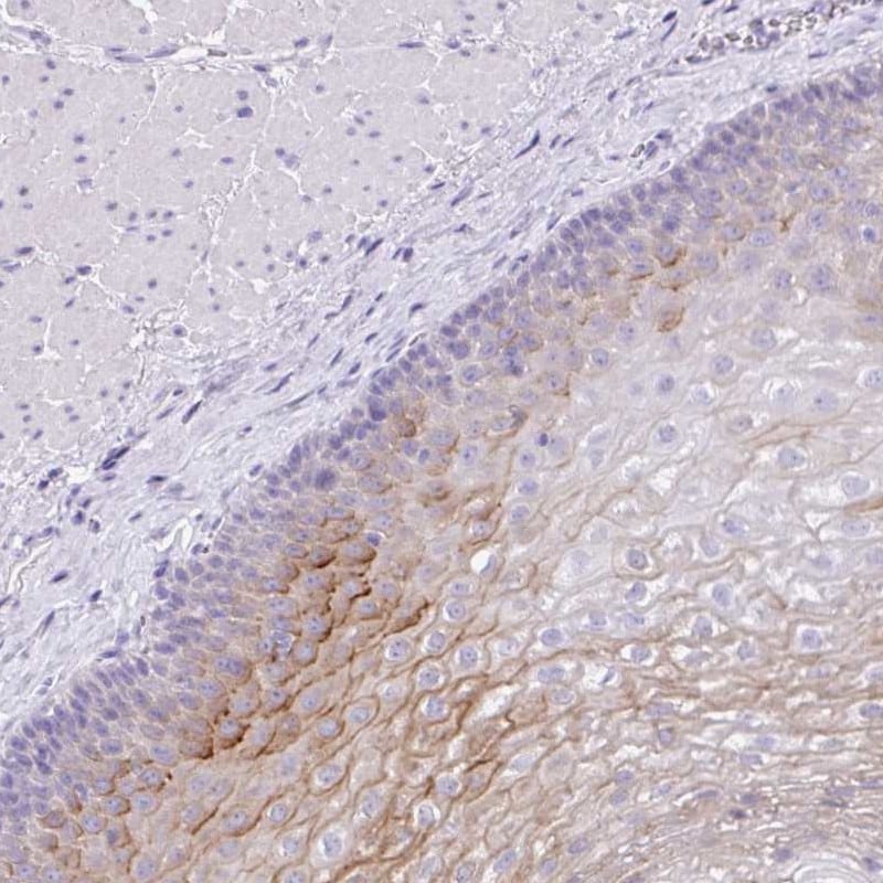 Kallikrein 8/Neuropsin Antibody - BSA Free Immunohistochemistry: Kallikrein 8/Neuropsin Antibody - BSA Free [NBP3-05517]