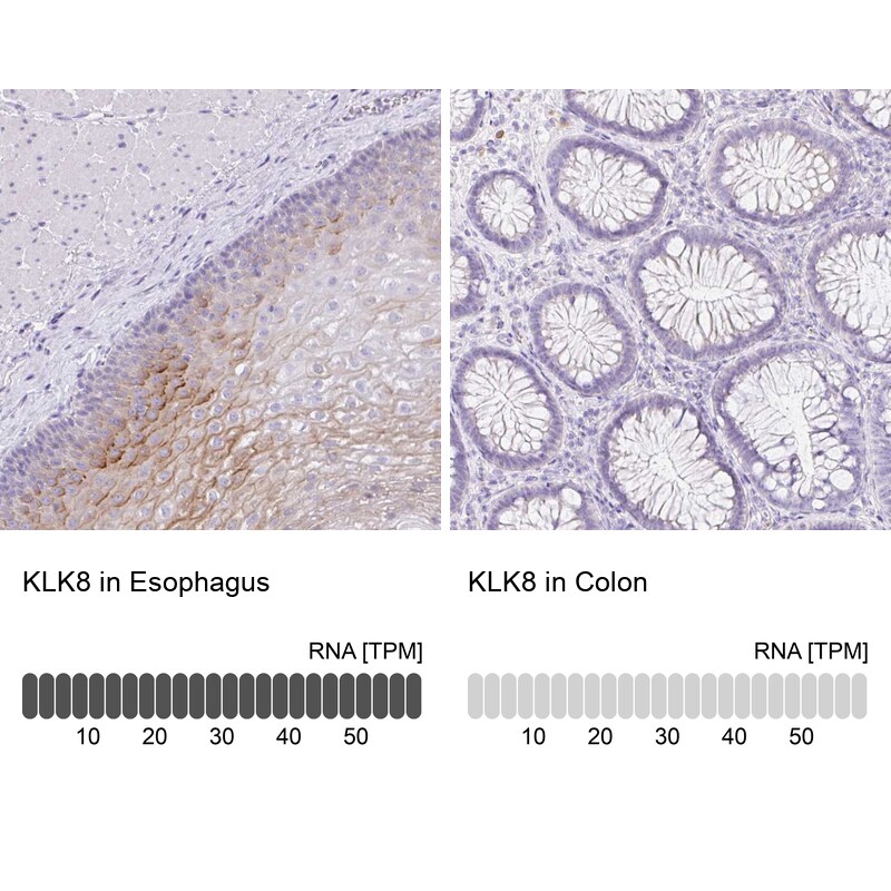 Kallikrein 8/Neuropsin Antibody - BSA Free Immunohistochemistry: Kallikrein 8/Neuropsin Antibody - BSA Free [NBP3-05517]