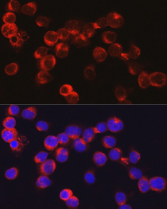 alpha-Defensin 1 Antibody - Azide and BSA Free
