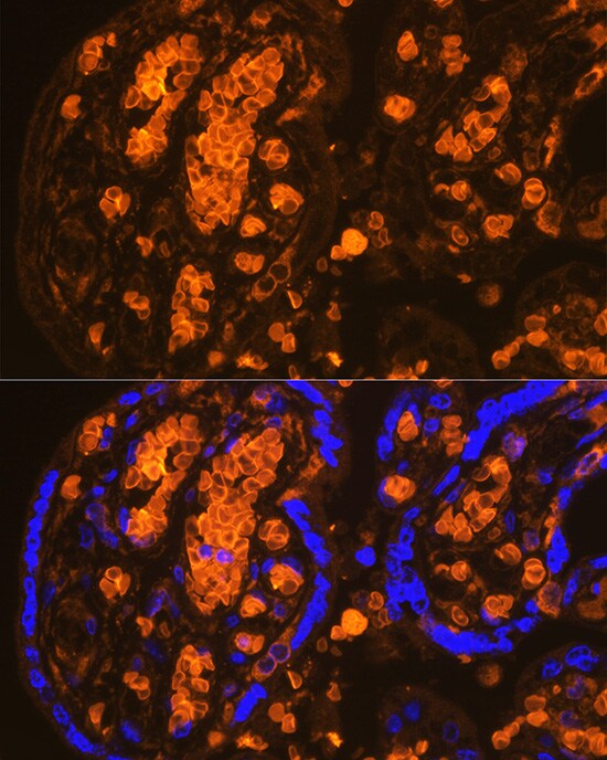 Hemoglobin A2 Antibody - BSA Free
