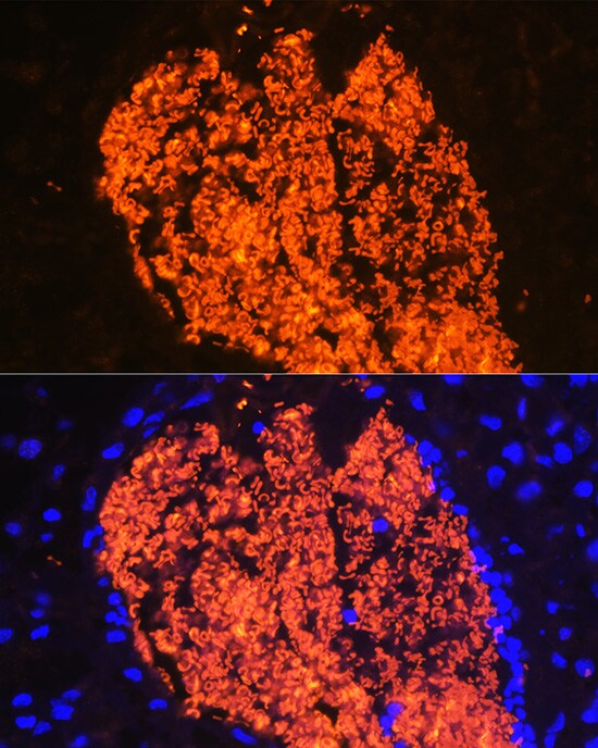 Hemoglobin A2 Antibody - BSA Free