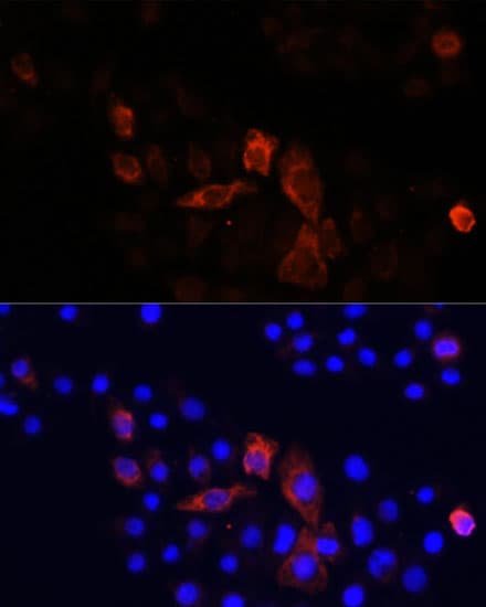MT-ND2 Antibody - Azide and BSA Free