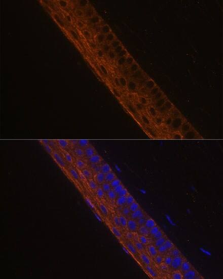 Myosin heavy chain 13 Antibody - Azide and BSA Free