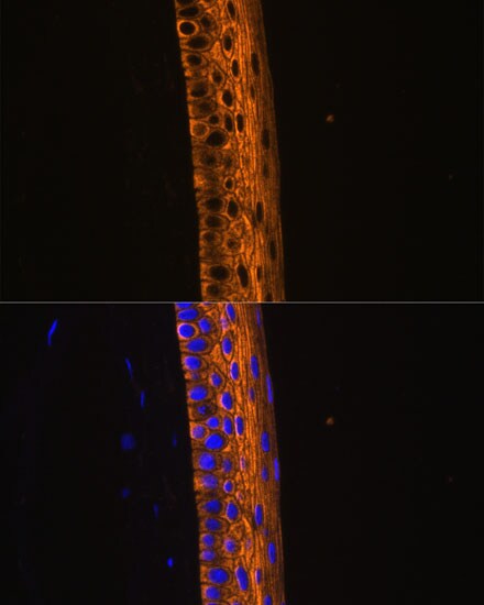 Myosin heavy chain 13 Antibody - Azide and BSA Free