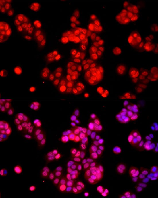 AMPK alpha 1/2 Antibody - Azide and BSA Free