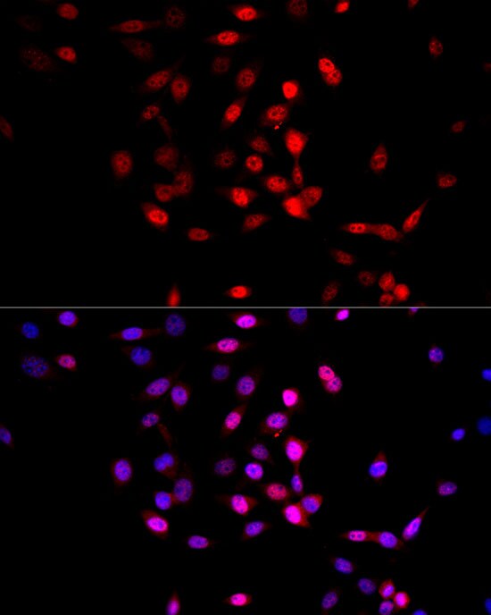 AMPK alpha 1/2 Antibody - Azide and BSA Free