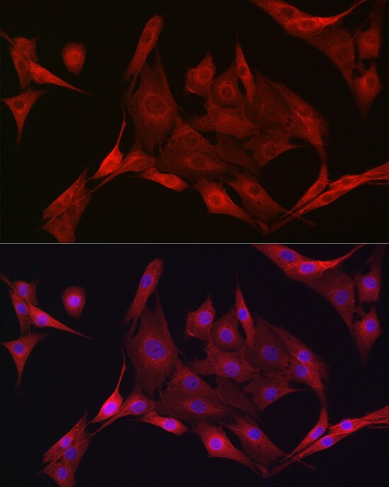 AMPK alpha 1/2 Antibody - Azide and BSA Free