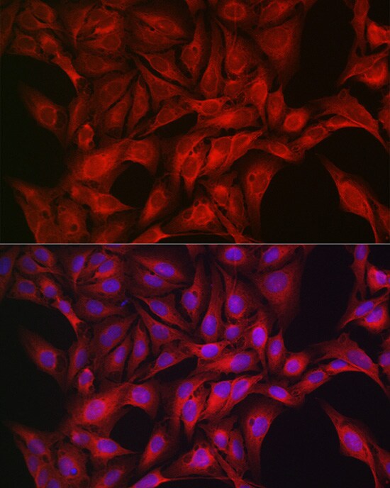 AMPK alpha 1/2 Antibody - Azide and BSA Free