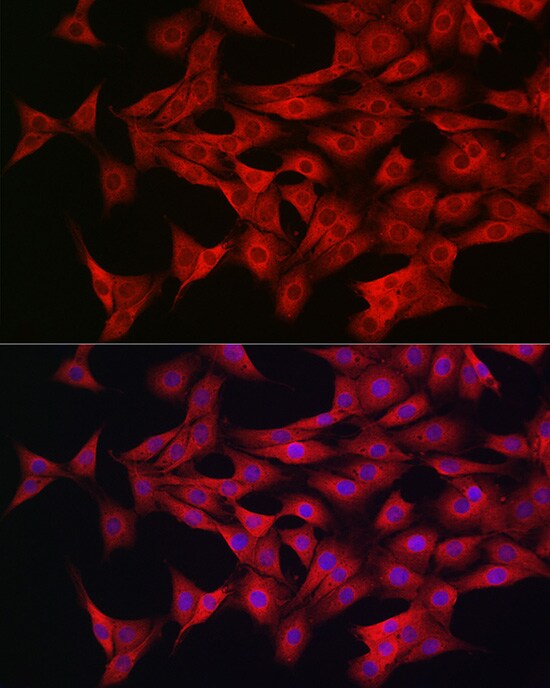 AMPK alpha 1/2 Antibody - Azide and BSA Free