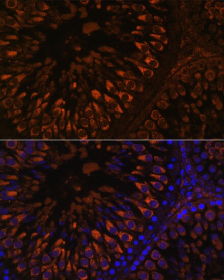 FER1L5 Antibody - Azide and BSA Free