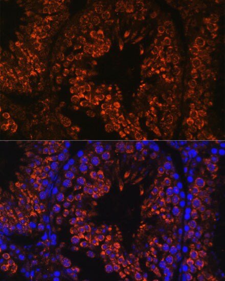 FER1L5 Antibody - Azide and BSA Free