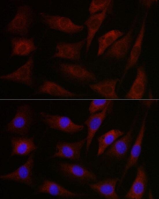 pan PKC Antibody - BSA Free